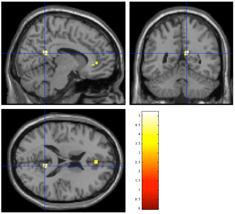 Ecco come un eccessivo Multitasking potrebbe influenzare il tuo Cervello